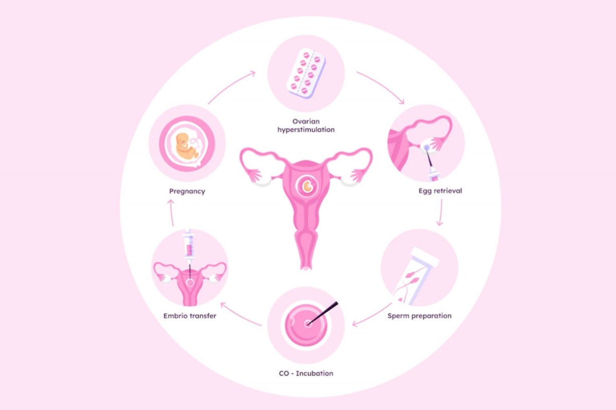 IVF Process Step