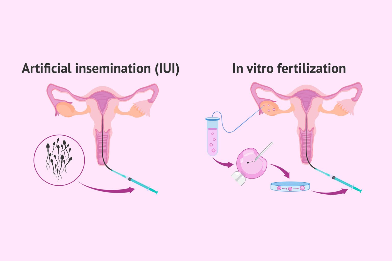 Ivf Vs Artificial Insemination Key Differences Explained