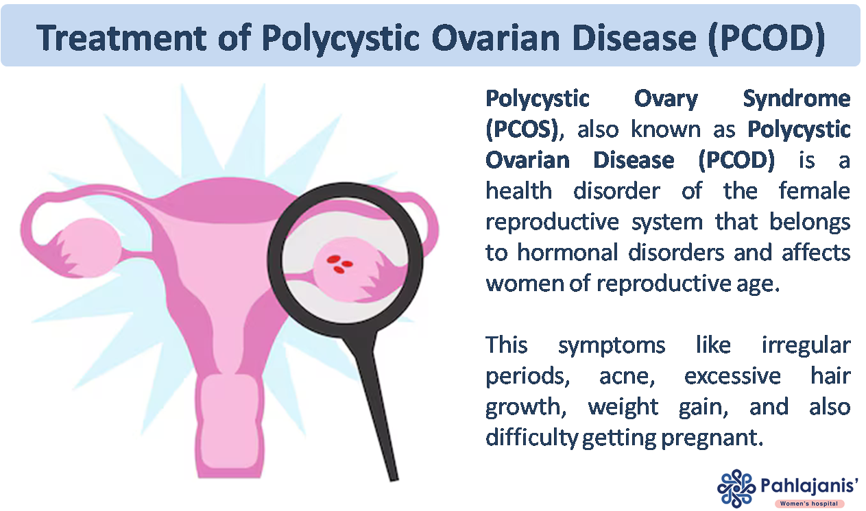 PCOD Polycystic Ovarian Disease Cause and Treatment