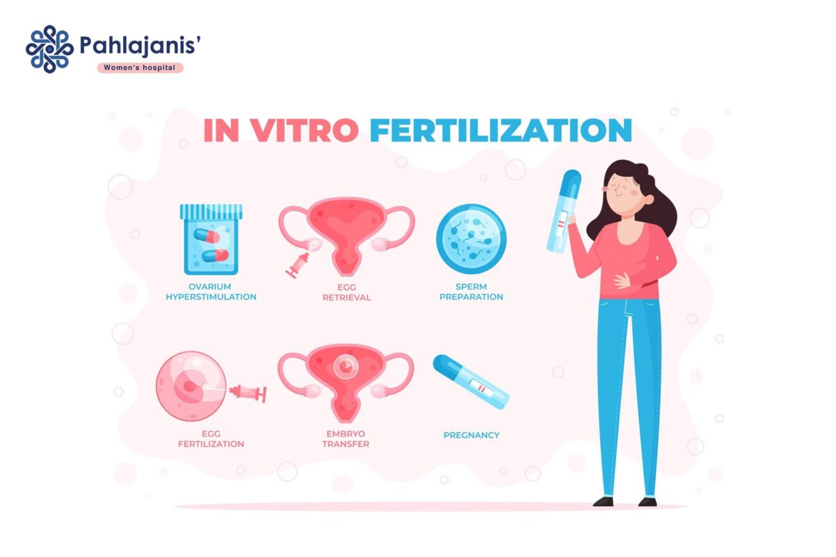 IVF Protocol for PCOS Patients