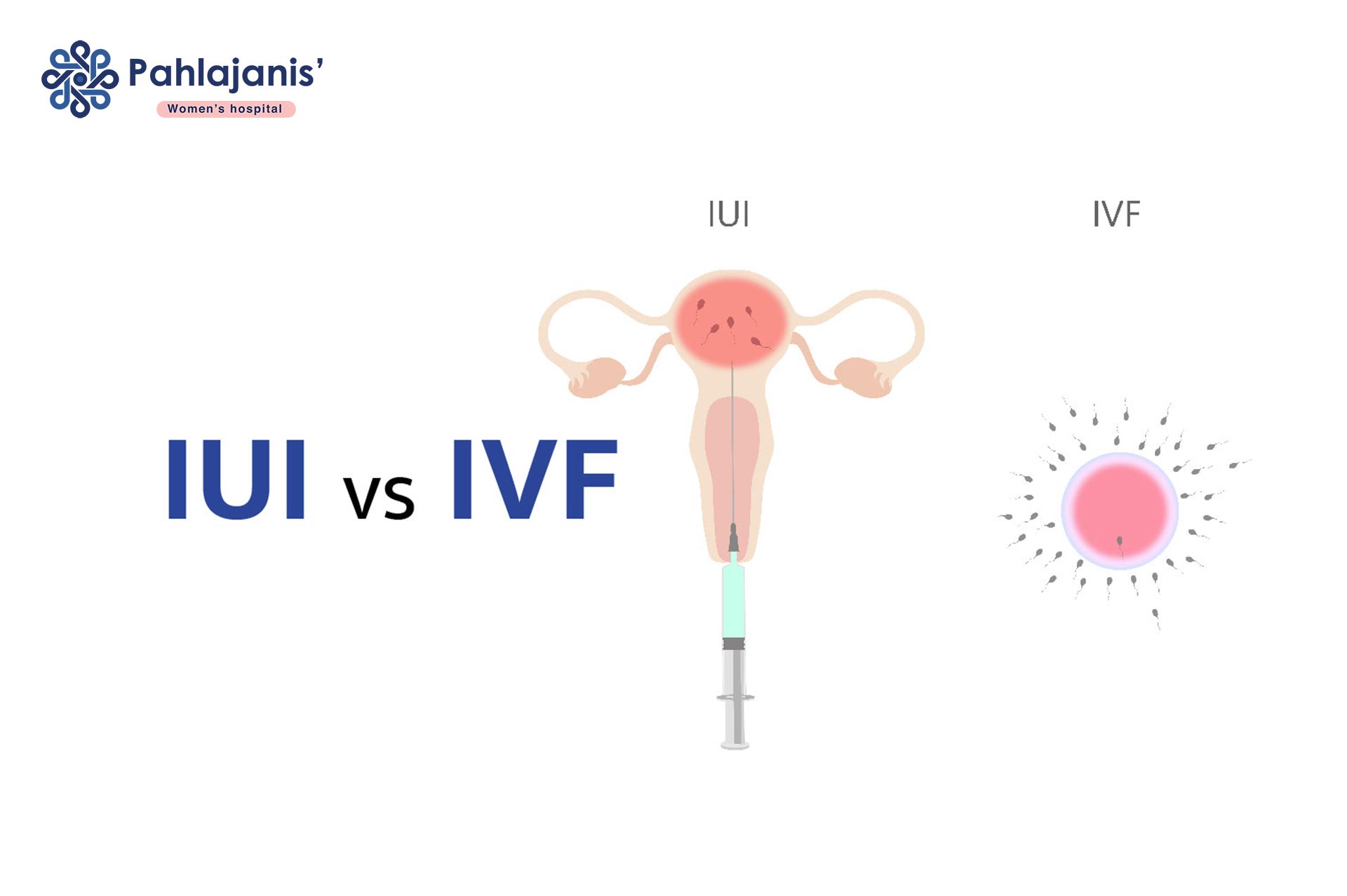 Whats The Difference Between Iui And Ivf