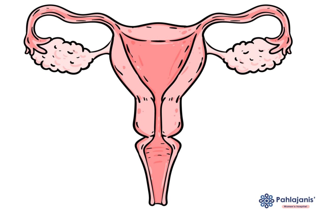 Ovarian Cysts