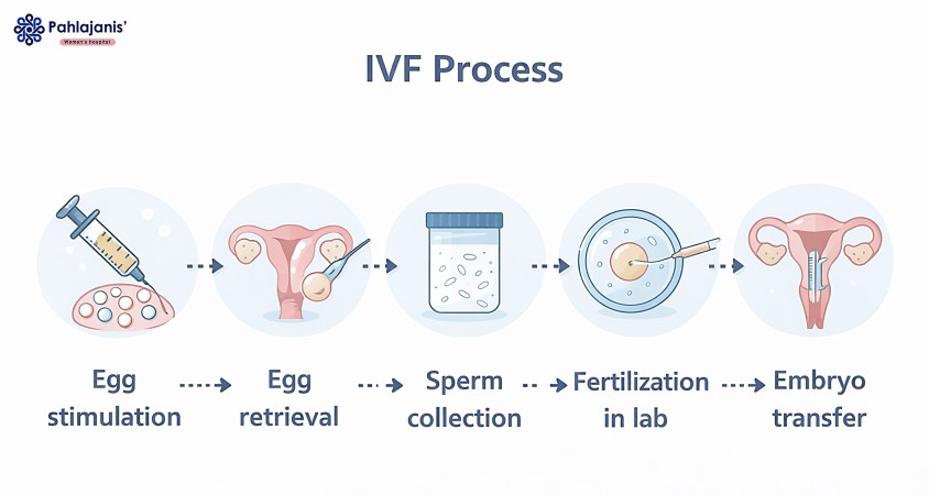 IVF Process